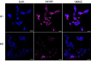 anti-Lectin, Mannose-Binding, 1 (LMAN1) antibody