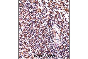 HCLS1 Antibody (C-term) ((ABIN657959 and ABIN2846904))immunohistochemistry analysis in formalin fixed and paraffin embedded human spleen tissue followed by peroxidase conjugation of the secondary antibody and DAB staining. (HCLS1 抗体  (C-Term))