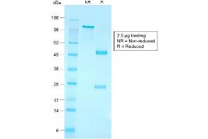 SDS-PAGE Analysis of Purified CD79a Rabbit Recombinant Monoclonal Antibody ABIN6383859. (Recombinant CD79a 抗体  (AA 202-216))