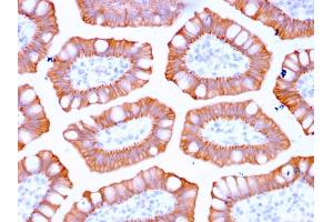 Formalin-fixed, paraffin-embedded human Colon stained with Cytokeratin 20 Recombinant Rabbit Monoclonal Antibody (KRT20/3129R). (Recombinant KRT20 抗体  (AA 196-323))
