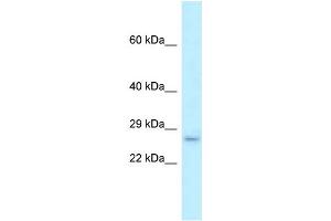 WB Suggested Anti-Fam176b Antibody Titration: 1. (EVA1B 抗体  (Middle Region))
