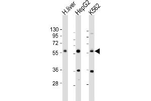 All lanes : Anti-NAGS Antibody (Center) at 1:1000 dilution Lane 1: human liver lysate Lane 2: HepG2 whole cell lysate Lane 3: K562 whole cell lysate Lysates/proteins at 20 μg per lane. (NAGS 抗体  (AA 275-309))