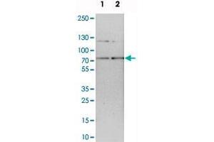 Western blot analysis of cell lysates with RNGTT polyclonal antibody . (RNGTT 抗体)