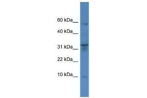 Western Blot showing CTSC antibody used at a concentration of 1-2 ug/ml to detect its target protein. (CTSC 抗体  (Middle Region))