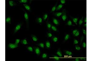Immunofluorescence of monoclonal antibody to XAB2 on HeLa cell. (XAB2 抗体  (AA 1-855))