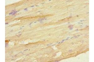 Immunohistochemistry of paraffin-embedded human skeletal muscle tissue using ABIN7153183 at dilution of 1:100 (FZD3 抗体  (AA 23-205))