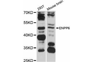 Western blot analysis of extracts of various cell lines, using ENPP6 antibody (ABIN5997678) at 1/1000 dilution. (ENPP6 抗体)