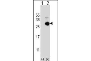 Western blot analysis of GSTO1 (arrow) using rabbit polyclonal GSTO1 Antibody (Center) (ABIN389475 and ABIN2839537). (GSTO1 抗体  (AA 126-155))