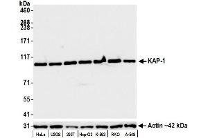 Western Blotting (WB) image for anti-Tripartite Motif Containing 28 (TRIM28) (Ser824) antibody (ABIN7454012) (Recombinant KAP1 抗体  (Ser824))