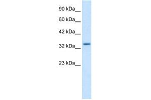 WB Suggested Anti-ZNF134 Antibody Titration:  1. (ZNF134 抗体  (Middle Region))