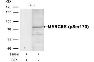 Western blot analysis of extracts from 3T3 cells, treated with serum or calf intestinal phosphatase (CIP), using MARCKS (phospho-Ser170) Antibody. (MARCKS 抗体  (pSer170))