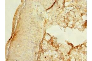 Immunohistochemistry of paraffin-embedded human skin tissue using ABIN7174599 at dilution of 1:100