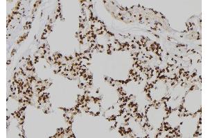 ABIN6256834 and ABIN6273541 at 1/100 staining Rat lung tissue by IHC-P. (JMJD2D 抗体  (N-Term))