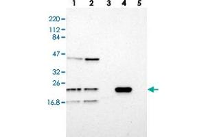 Western blot analysis of Lane 1: RT-4, Lane 2: U-251 MG, Lane 3: Human Plasma, Lane 4: Liver, Lane 5: Tonsil with LDOC1L polyclonal antibody  at 1:250-1:500 dilution. (LDOC1L 抗体)