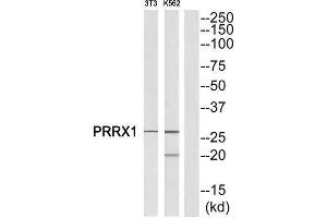 Western Blotting (WB) image for anti-Paired Related Homeobox 1 (PRRX1) (Internal Region) antibody (ABIN1851770) (PRRX1 抗体  (Internal Region))