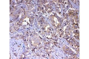 IHC analysis of IQGAP2 using antiIQGAP2 antibody (ABIN5692877). (IQGAP2 抗体  (AA 1329-1544))