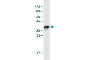 Western Blot detection against Immunogen (36. (SHANK1 抗体  (AA 2088-2161))