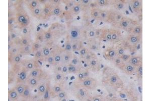 Immunohistochemistry (IHC) image for anti-Topoisomerase (DNA) III alpha (TOP3A) (AA 35-179) antibody (ABIN7435616)