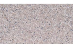 Detection of TRADD in Human Liver Tissue using Polyclonal Antibody to TNFRSF1A Associated Via Death Domain Protein (TRADD) (TRADD 抗体  (AA 61-297))