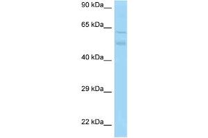WB Suggested Anti-Pacsin3 Antibody Titration: 1. (PACSIN3 抗体  (C-Term))