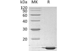 Western Blotting (WB) image for Interleukin 1 alpha (IL1A) protein (ABIN7320583) (IL1A 蛋白)