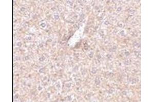 Immunohistochemistry of STEAP3 in mouse liver tissue with this product at 2. (STEAP3 抗体  (N-Term))