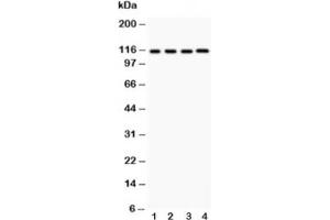 Western blot testing of NALP3 antibody and Lane 1:  HeLa (NLRP3 抗体  (AA 21-194))