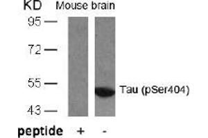 Image no. 1 for anti-Microtubule-Associated Protein tau (MAPT) (pSer404) antibody (ABIN196810) (MAPT 抗体  (pSer404))