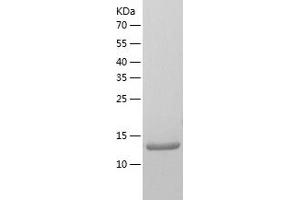 KH Homology Domain Containing 1-Like (KHDC1L) (AA 1-128) protein (His tag)