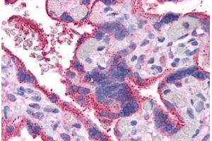 Immunohistochemistry (Formalin-fixed Paraffin-embedded Sections) (IHC (fp)) image for anti-Wingless-Type MMTV Integration Site Family, Member 5A (WNT5A) (AA 180-229) antibody (ABIN574490)
