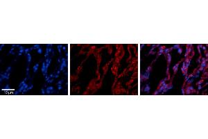 Rabbit Anti-TAP1 Antibody     Formalin Fixed Paraffin Embedded Tissue: Human Lung Tissue  Observed Staining: Cytoplasmic in alveolar type I & II cells  Primary Antibody Concentration: 1:100  Secondary Antibody: Donkey anti-Rabbit-Cy3  Secondary Antibody Concentration: 1:200  Magnification: 20X  Exposure Time: 0. (TAP1 抗体  (Middle Region))