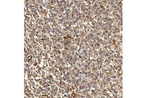 IHC analysis of RAB7/RAB7A using anti-RAB7/RAB7A antibody (ABIN7600597). (RAB7A 抗体  (AA 21-177))