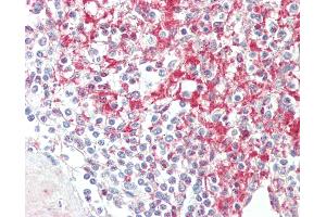 Anti-ADAM19 antibody IHC staining of human spleen. (ADAM19 抗体  (AA 574-588))