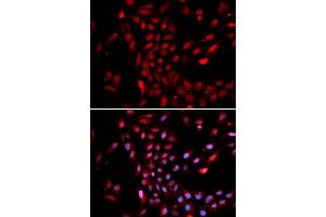 Immunofluorescence (IF) image for anti-Karyopherin (Importin) alpha 4 (KPNA4) (AA 1-240) antibody (ABIN3015855)