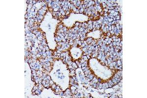 Immunohistochemistry (IHC) image for anti-Isocitrate Dehydrogenase 3 (NAD+) alpha (IDH3A) (AA 28-366) antibody (ABIN7268029)