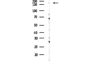 Western blot analysis of lysates from COLO205 cells(heat-shock,45 min treatment), using Tensin-1 Antibody at 1/1000 dilution.