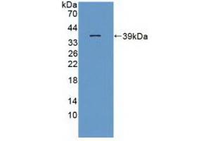 Western blot analysis of recombinant Rat ITaC. (CXCL11 抗体  (AA 22-100))