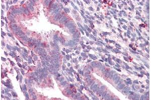 Anti-STEAP2 antibody  ABIN960822 IHC staining of human uterus. (STEAP2 抗体  (C-Term))
