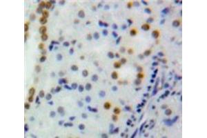 Used in DAB staining on fromalin fixed paraffin-embedded Kidney tissue (DNMT1 抗体  (AA 1343-1570))