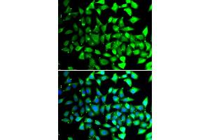 Immunofluorescence analysis of A549 cells using COPS6 antibody (ABIN5974254). (COPS6 抗体)