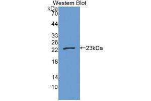 Western blot analysis of the recombinant protein. (CPT1B 抗体  (AA 602-772))