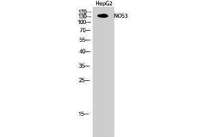 Western Blotting (WB) image for anti-Nitric Oxide Synthase 3 (Endothelial Cell) (NOS3) (Thr180) antibody (ABIN3185940) (ENOS 抗体  (Thr180))