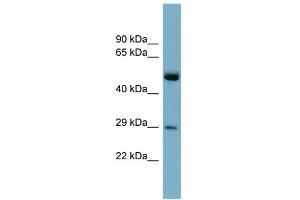 WB Suggested Anti-RAB27A Antibody Titration: 0. (RAB27A 抗体  (Middle Region))