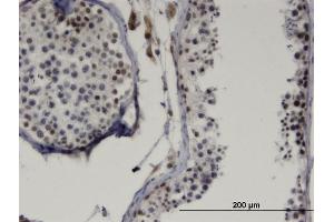 Immunoperoxidase of monoclonal antibody to LMX1B on formalin-fixed paraffin-embedded human testis. (LMX1B 抗体  (AA 1-110))