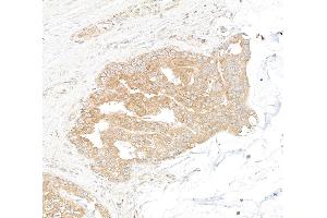 Immunohistochemistry (IHC) image for anti-DEAD (Asp-Glu-Ala-Asp) Box Polypeptide 6 (DDX6) (AA 1-50) antibody (ABIN7453871)