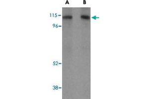 Western blot analysis of LAMP2 in HepG2 cell lysate with LAMP2 polyclonal antibody  at (A) 1 and (B) 2 ug/mL . (LAMP2 抗体)