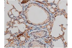 Immunohistochemistry (IHC) image for anti-GATA Binding Protein 1 (Globin Transcription Factor 1) (GATA1) (pSer142) antibody (ABIN6254982)