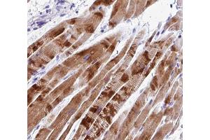ABIN6266808 at 1/100 staining human Skeletal muscle tissue sections by IHC-P. (C2orf40 抗体  (C-Term))