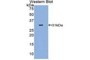 Western Blotting (WB) image for anti-Signal Transducer and Activator of Transcription 2, 113kDa (STAT2) (AA 616-849) antibody (ABIN1860648) (STAT2 抗体  (AA 616-849))