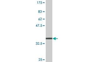 Western Blot detection against Immunogen (37. (MAGED2 抗体  (AA 16-125))